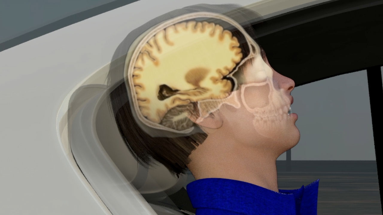Injury mechanism visualization showing head anatomy overlaid within a vehicle occupant scene.